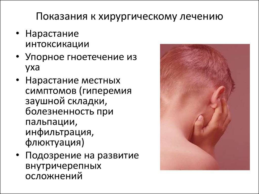 Отиты у детей. лечение