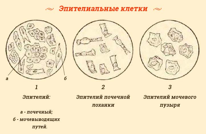 Белок в моче: причины появления белка в моче, консультация уролога в клинике