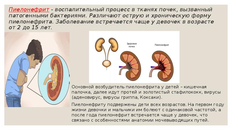 Пиелонефрит у грудничка: причины, симптомы, лечение | spravki1.ru