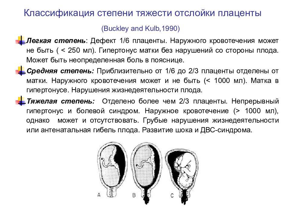 Предлежание плаценты - причины, симптомы, диагностика, лечение и профилактика