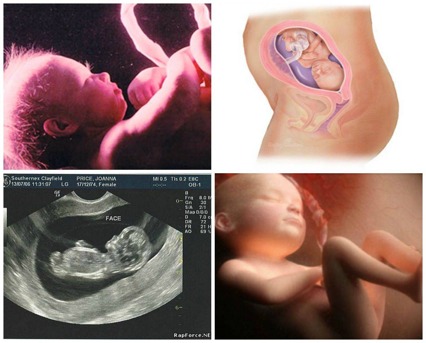 27 неделя беременности: ощущения, симптомы и основные признаки развития плода, медицинские рекомендации и обследования