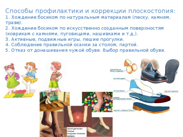 Плоскостопие у детей: причины, профилактика и методы лечения