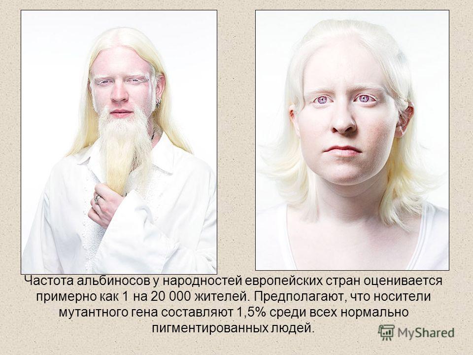 Альбинизм, симптомы и лечение альбинизма | медицинский центр липецка