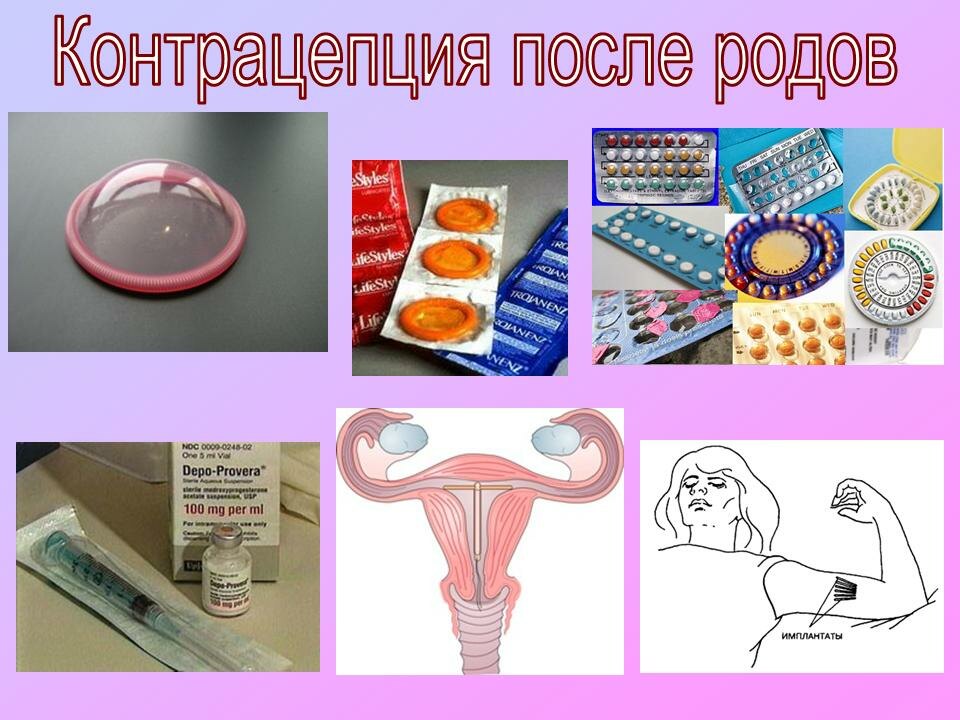 Предохранение после беременности. Послеродовая контрацепция. Контрацепция после родов. Противозачаточные способы. Методы контрацепции после родов.