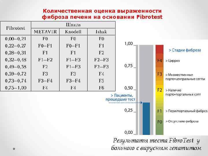 Гепатиты у детей - симптомы, клинические рекомендации по лечению детского вирусного гепатита