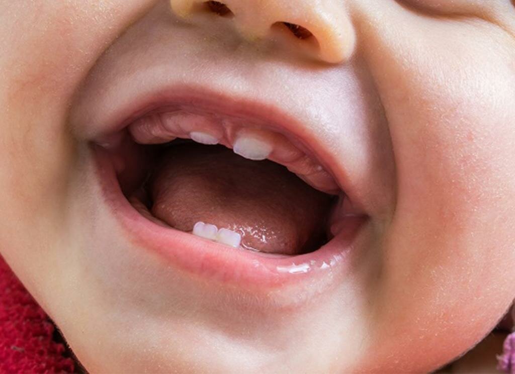 Схема прорезывания молочных и постоянных зубов у детей