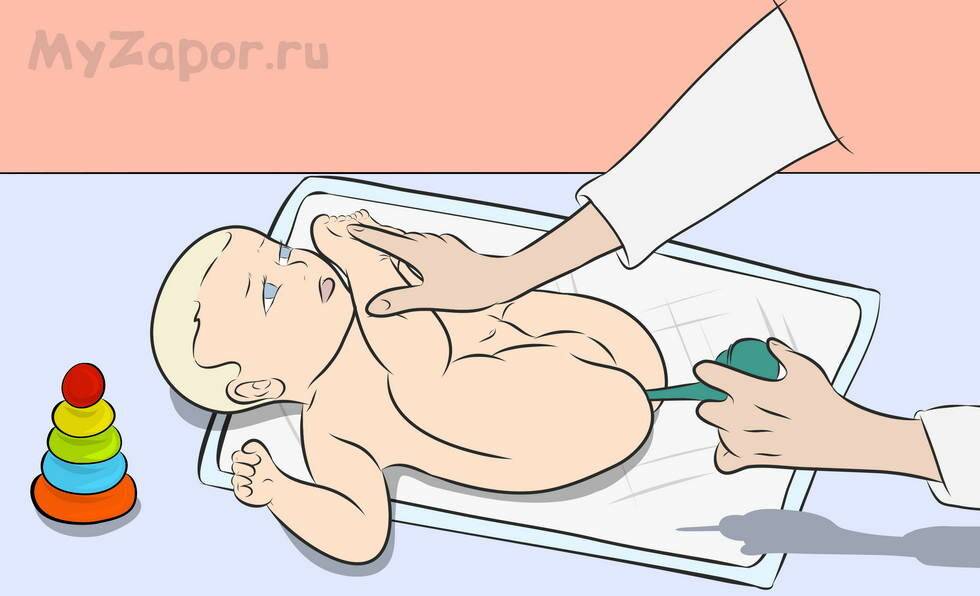 Упражнения для кишечника, от вздутия и запоров – усиление перистальтики