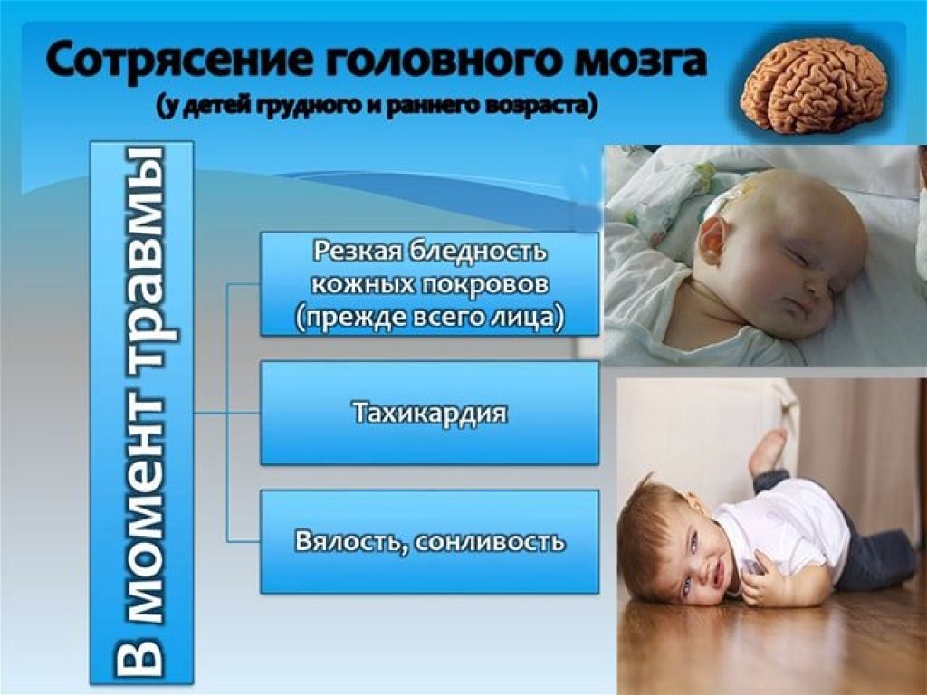 Черепно-мозговые травмы у детей - какие могут быть последствия черепно-мозговых травм у детей?