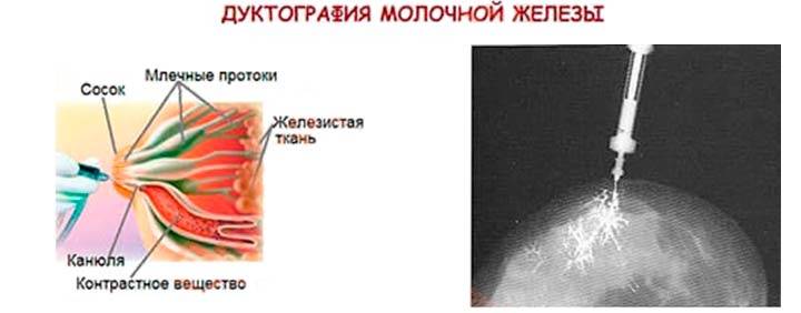 Белые точки на сосках у женщин: причины и лечение. консультация маммолога :: syl.ru
