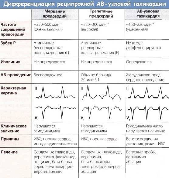 Тахикардия | симптомы | диагностика | лечение - docdoc.ru