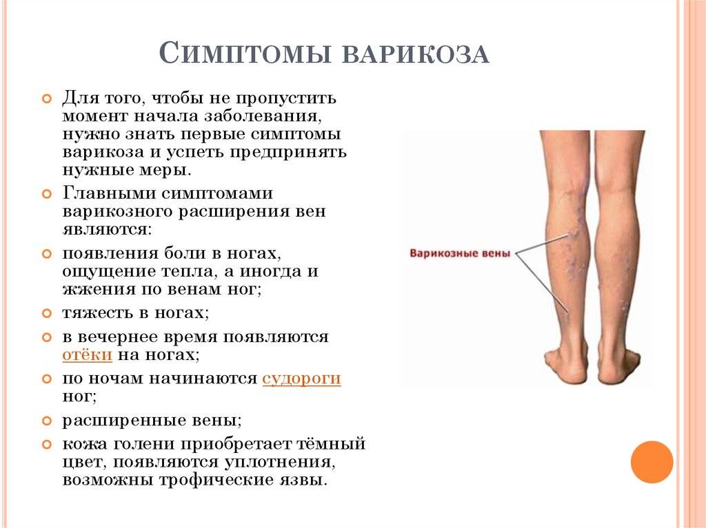 Отёки во время беременности