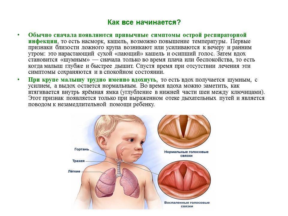 Аденоиды у ребенка - откуда берутся, признаки и симптомы