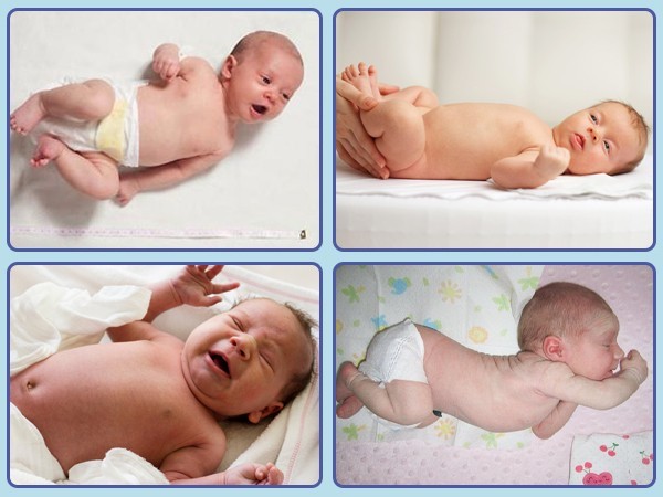 Гипертонус у новорожденного не диагноз: причины и способы решения проблемы