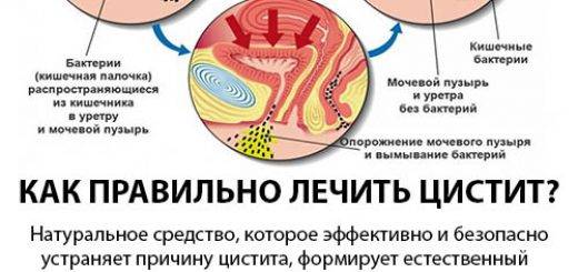 Нерегулярная половая жизнь - последствия и профилактика