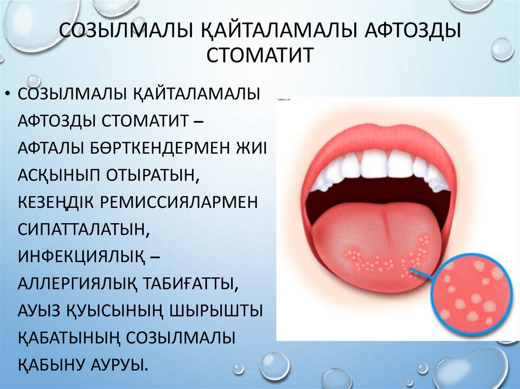 Стоматит у детей: симптомы и лечение, причины и виды | семейный доктор