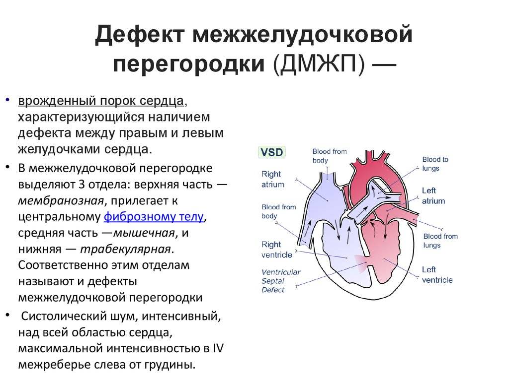 ᐈ чем опасен порок сердца? ~【диагностика и лечение в киеве】