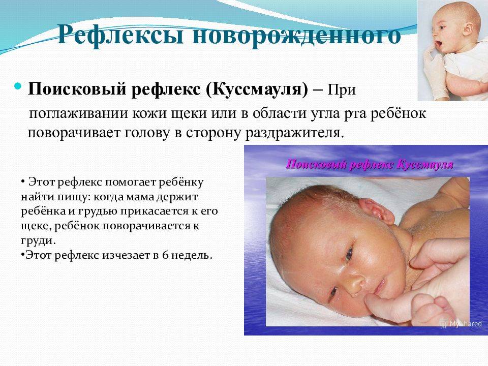 3 врожденных рефлексов. Куссмауля рефлекс у новорожденного. Поисковый и хоботковый рефлекс у новорожденного. Поисковый рефлекс Куссмауля. Поисковый рефлекс Куссмауля новорожденного.