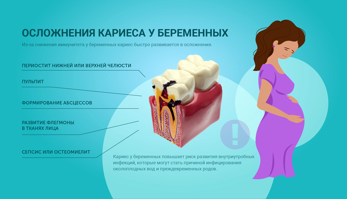 Можно ли лечить зубы при беременности — элитдентал м.