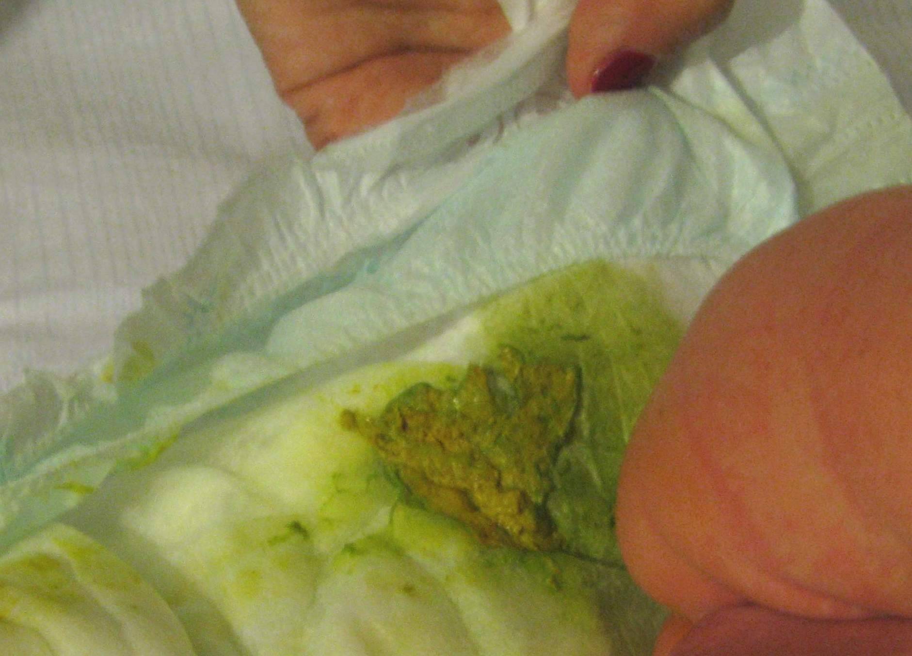Зеленый стул у грудничка: почему бывает у новорожденного ребенка, что делать