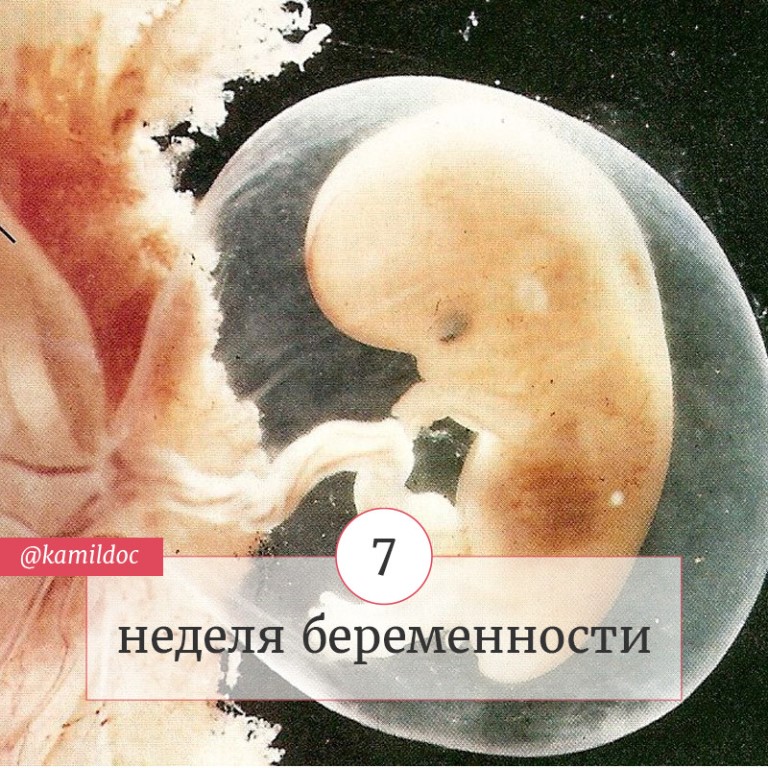 7 неделя беременности: что происходит с малышом и мамой, как развивается плод на этом сроке?