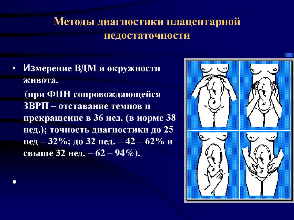 Ведение беременности при фетоплацентарной недостаточности — фетоплацентарная недостаточность во время беременности — 8(495)120-02-05