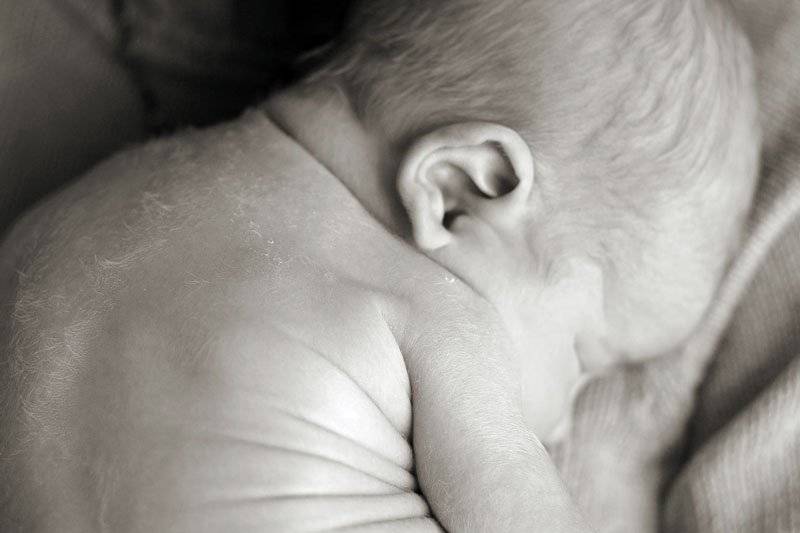 «укус аиста» и «поцелуй ангела»: «родовые пятна» у новорожденных - ecocenter.by