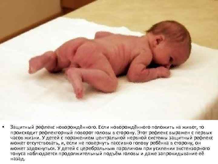 Выкладывание новорожденного на живот