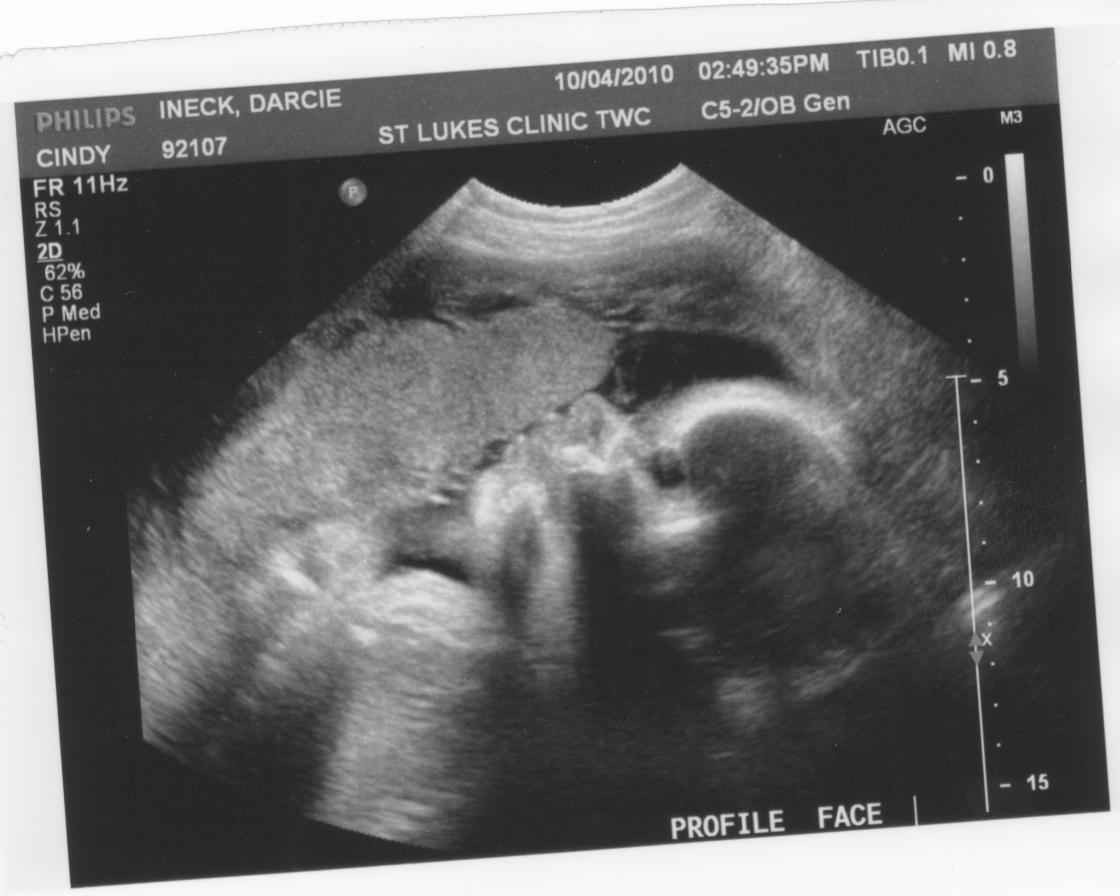 32 недели беременности | клиника ведения беременности в пятигорске