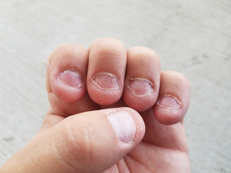 Как отучить ребенка грызть ногти: причины, советы психолога, комаровского