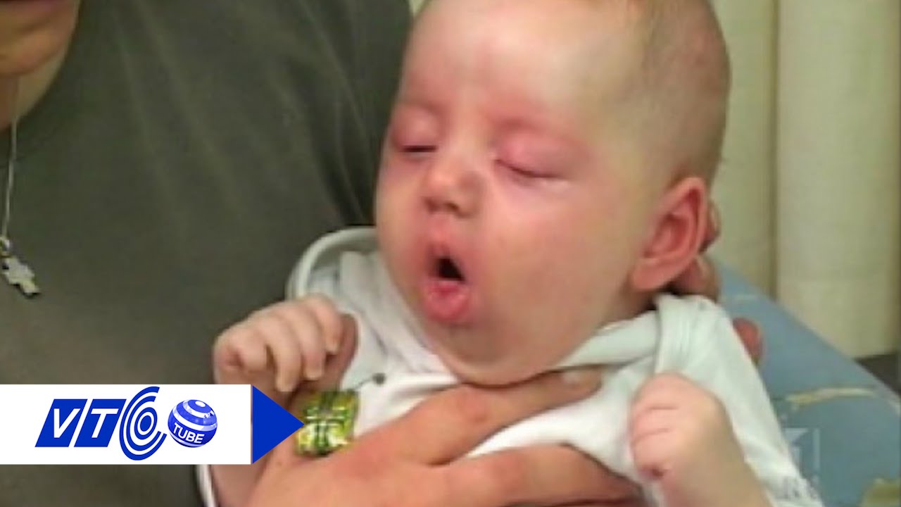Срыгивает через нос и рот. У грудничка кашель у грудничка. Кашель у новорожденного 1. Ребенок кашляет.