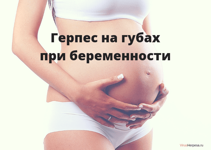 Герпес на губах при беременности - виферон
