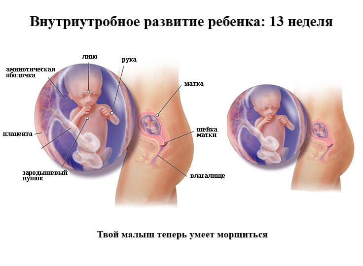 Беременность  13 недель