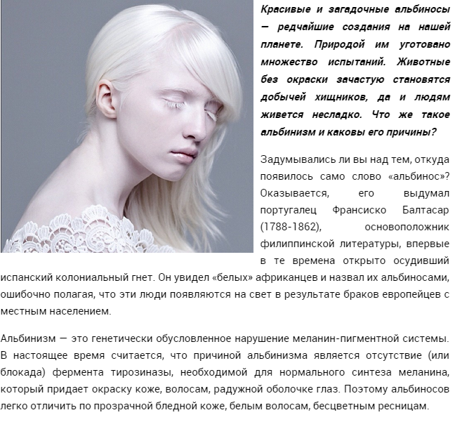 «белая ворона», или особенности здоровья и развития ребенка-альбиноса