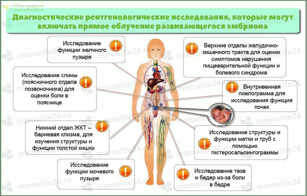 Можно ли беременным делать флюорографию, какие могут быть последствия pulmono.ru
можно ли беременным делать флюорографию, какие могут быть последствия