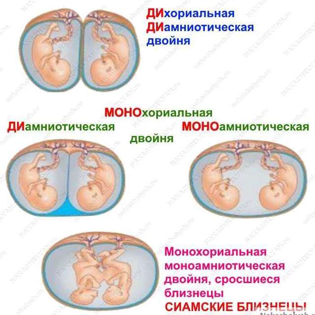 Беременность двойней по неделям - ощущения, развитие, размер, вес плода, фото животиков