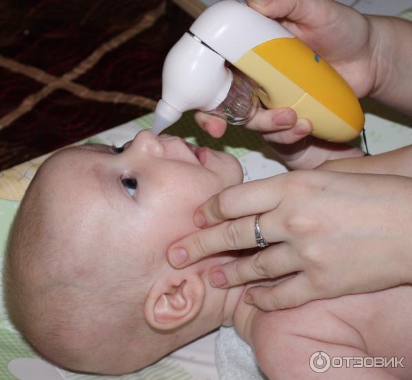 Как почистить нос от соплей. Для отсасывания соплей у младенца. Откачивание соплей у грудничка. Приспособление для отсасывания соплей у грудных детей. Отсасывание слизи у новорожденных.