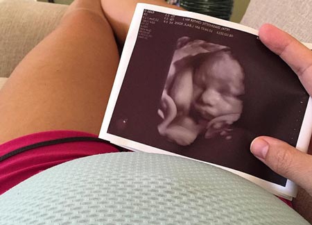 Ребенок на 33 неделе беременности фото