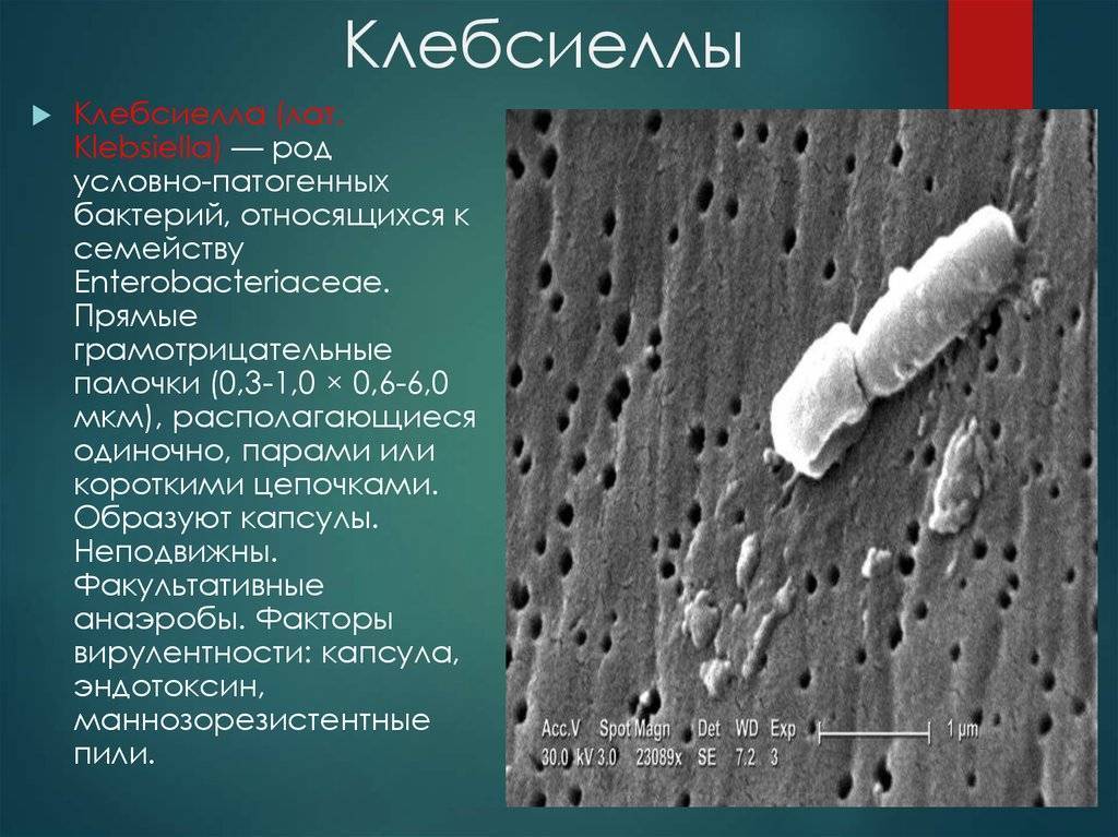 Клебсиелла у грудничка (пневмония) в кале: симптомы, лечение мнение комаровского
