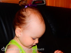 Медленно растут волосы у ребенка — 5 причин этого явления | bellehair.info
