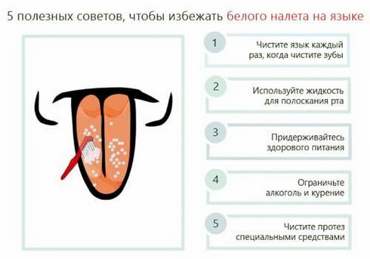 Белый налет на языке у грудничка: причины образования, способы удаления и общий подход к лечению