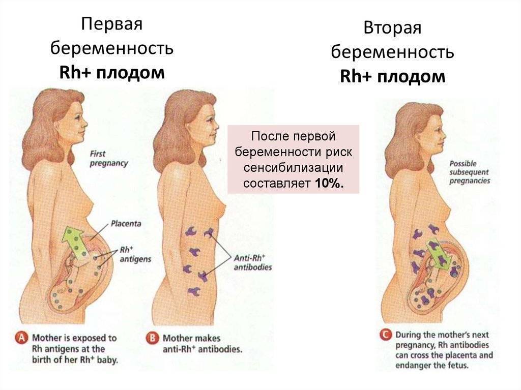 Тянет (болит) низ живота при беременности на 1, 2, 3 триместре