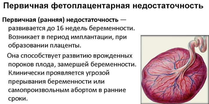 Фетоплацентарная недостаточность: признаки, лечение, профилактика; чем опасна фпн / mama66.ru