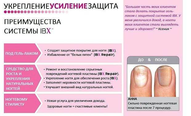 Можно ли красить ногти гель-лаком при беременности. вреден ли гель-лак во время беременности — беременность. беременность по неделям.