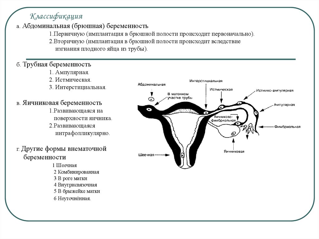 Забеременеть после внематочной беременности с одной трубой. Трубная беременность классификация. Внематочная Трубная ампулярная беременность. Внематочная беременность схема. Истмическая внематочная беременность.