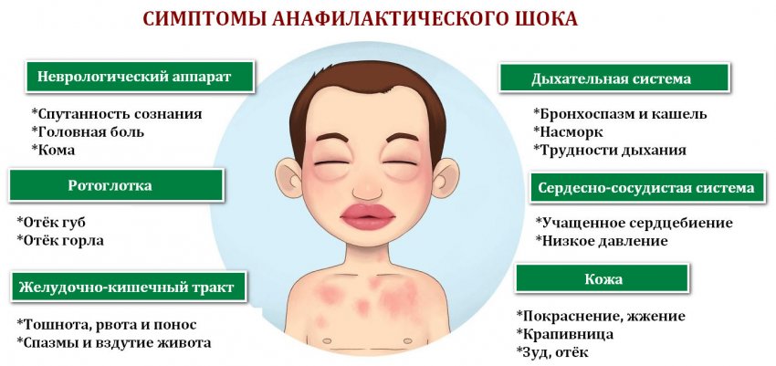 Диатез | симптомы | диагностика | лечение - docdoc.ru