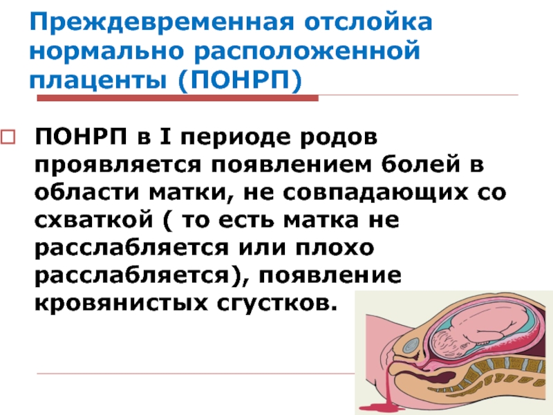 Отслойка плаценты на поздних сроках беременности: причины, признаки, последствия