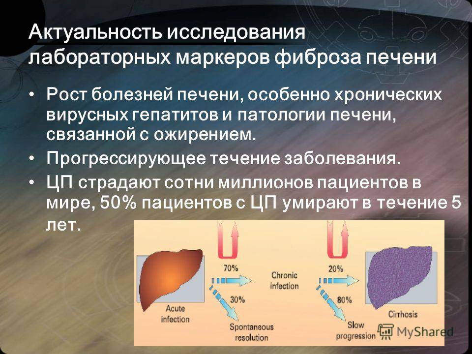 Узи печени
