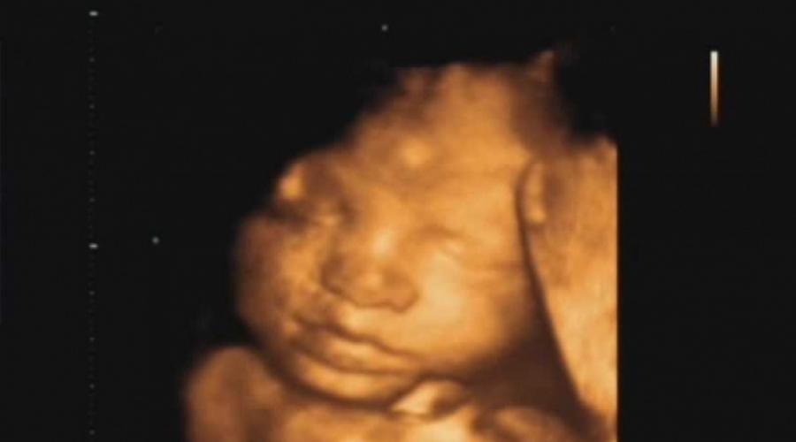 22 неделя беременности – полное описание, фото, узи, советы