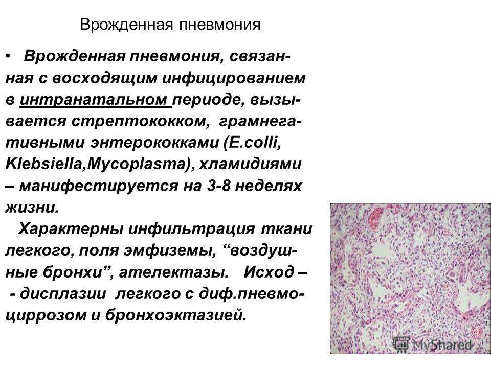 Избыточный бактериальный рост в тонкой кишке - синдром излишнего бактериального роста (сибр, sibo) | университетская клиника