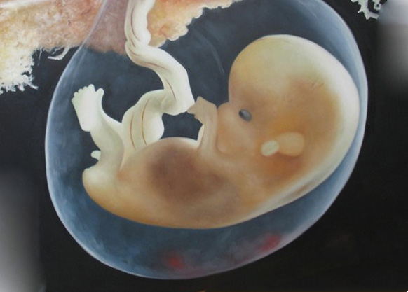 7 недель | клиника ведения беременности в пятигорске
